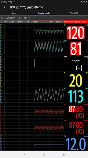 Download Mindray Mobile Viewer: Monitoramento Médico Remoto - Screenshot 15