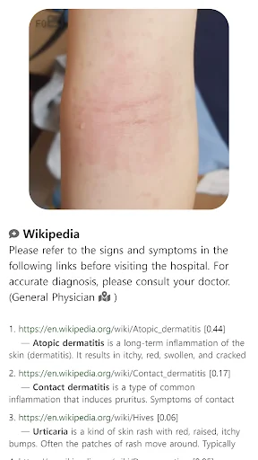 Baixar Model Dermatol – Atlas de Doenças de Pele Grátis - Screenshot 13