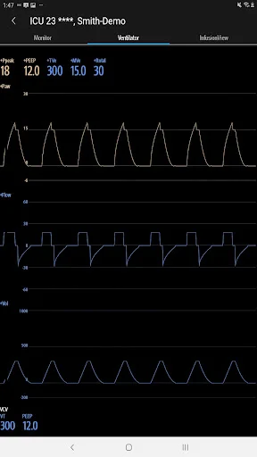 Download Mindray Mobile Viewer: Monitoramento Médico Remoto - Screenshot 12