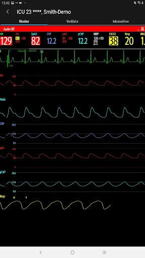 Download Mindray Mobile Viewer: Monitoramento Médico Remoto - Screenshot 19