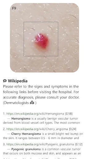Baixar Model Dermatol – Atlas de Doenças de Pele Grátis - Screenshot 11