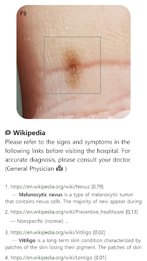 Baixar Model Dermatol – Atlas de Doenças de Pele Grátis - Screenshot 10