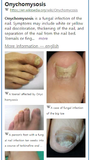 Baixar Model Dermatol – Atlas de Doenças de Pele Grátis - Screenshot 2